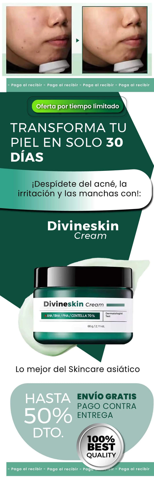¡Skincare asiático!: DivineSkin Cream PARA ACNÉ Y MANCHAS 😍